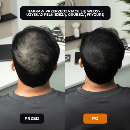 Lugaro | 💥 Pożegnaj się z przerzedzonymi włosami — Natychmiast! | Odkryj sekret pełniejszego, naturalnego wyglądu w kilka sekund