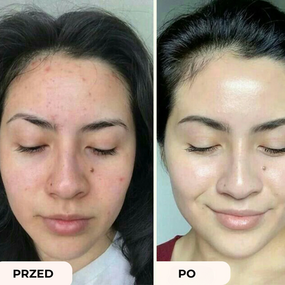 Luméa Seoul 1988 Serum | Blask zaczyna się tutaj: Delikatne, a zarazem skuteczne serum, które pokocha Twoja skóra