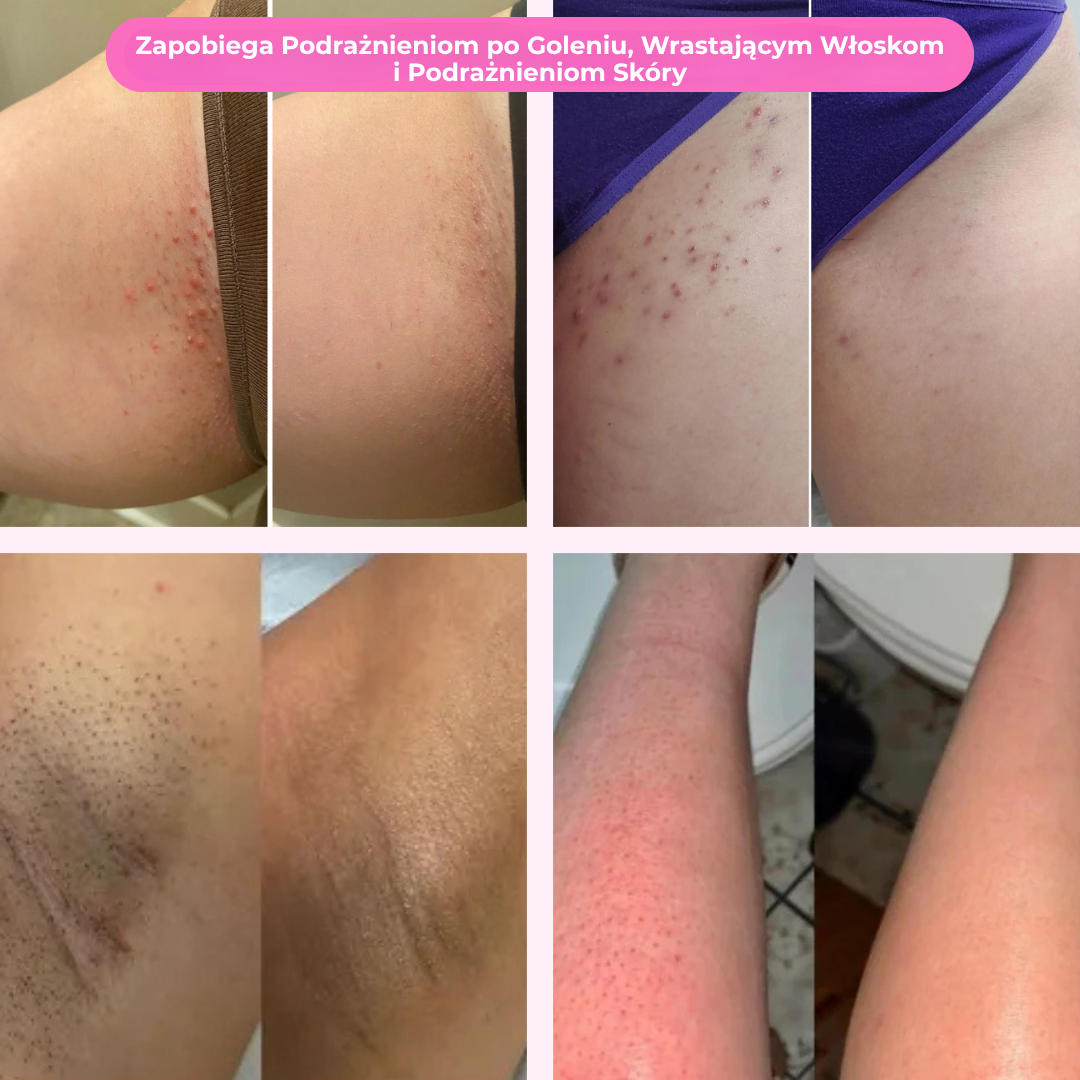 SmoothSkin™ | Golenie to koszmar? Już nie — poznaj maszynkę, która zmienia wszystko