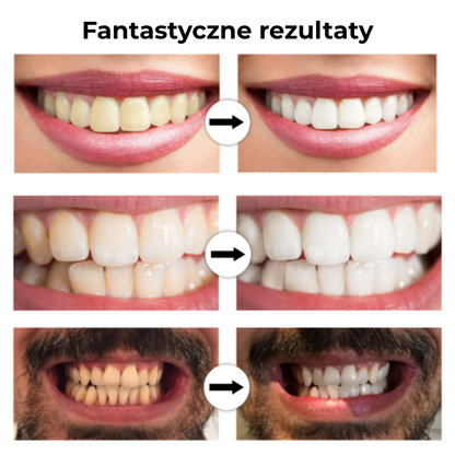 SmileBright™ - Rozjaśnij swój uśmiech, bez wysiłku. Wybielanie inspirowane kliniką.