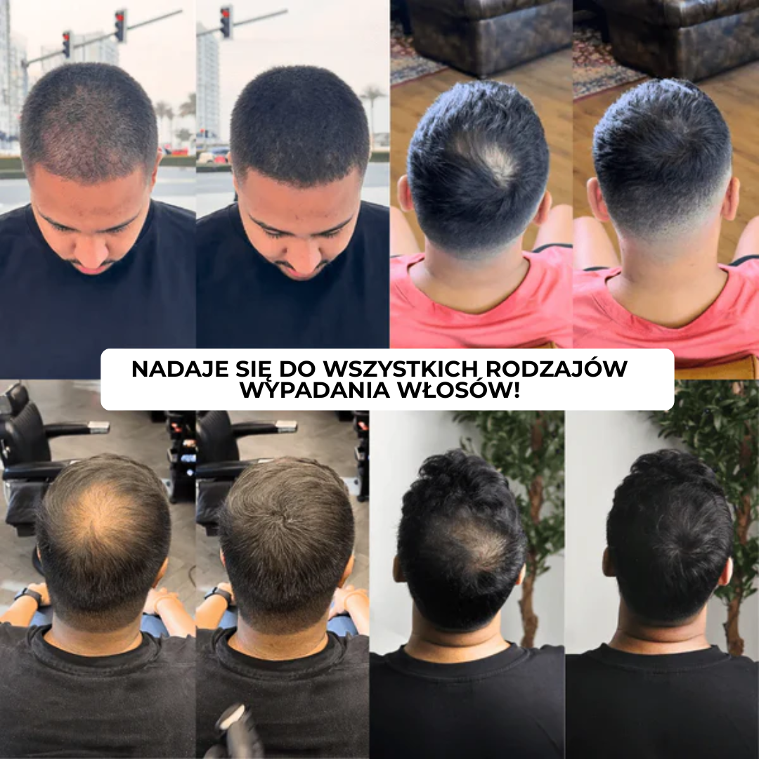 Lugaro | 💥 Pożegnaj się z przerzedzonymi włosami — Natychmiast! | Odkryj sekret pełniejszego, naturalnego wyglądu w kilka sekund