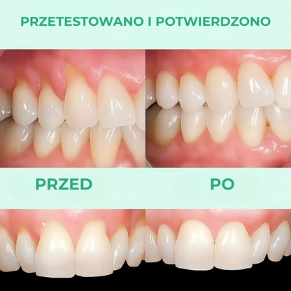 GumCare™ | Zdrowsze dziąsła, świeższy oddech – widoczne rezultaty już w kilka tygodni!