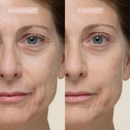 SkinTite™ | Natychmiastowy efekt przeciw opuchliźnie i zmarszczkom