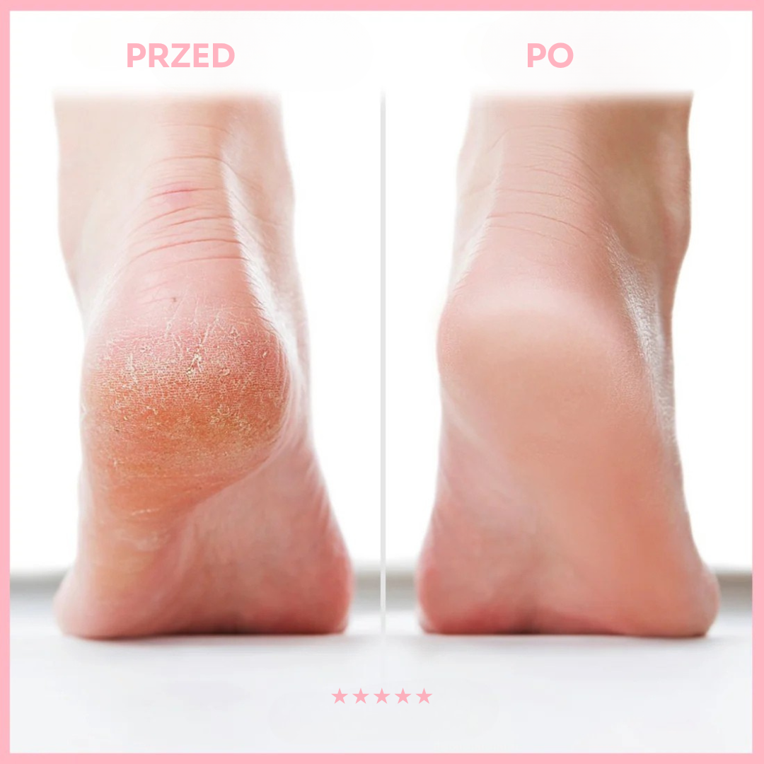 SilkSula™ – jedwabiście gładkie stopy bez wysiłku✨