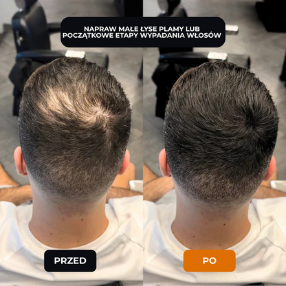 Lugaro | 💥 Pożegnaj się z przerzedzonymi włosami — Natychmiast! | Odkryj sekret pełniejszego, naturalnego wyglądu w kilka sekund