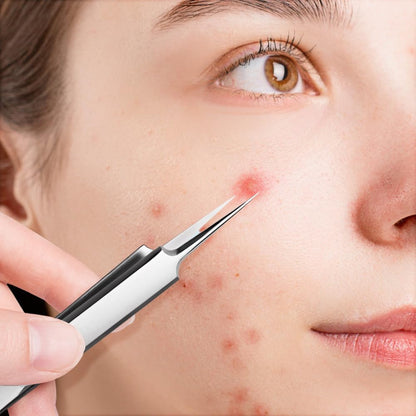 PoreClean™  | Czysta skóra, pewność siebie