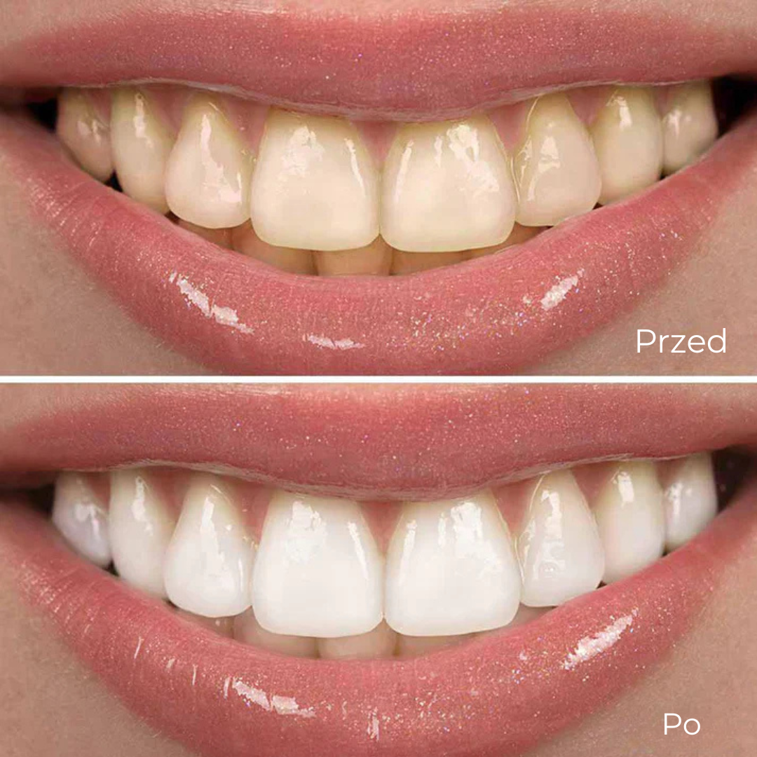 PerłaSmile™ | Szybki i delikatny sposób na bielsze zęby – gdziekolwiek i kiedykolwiek