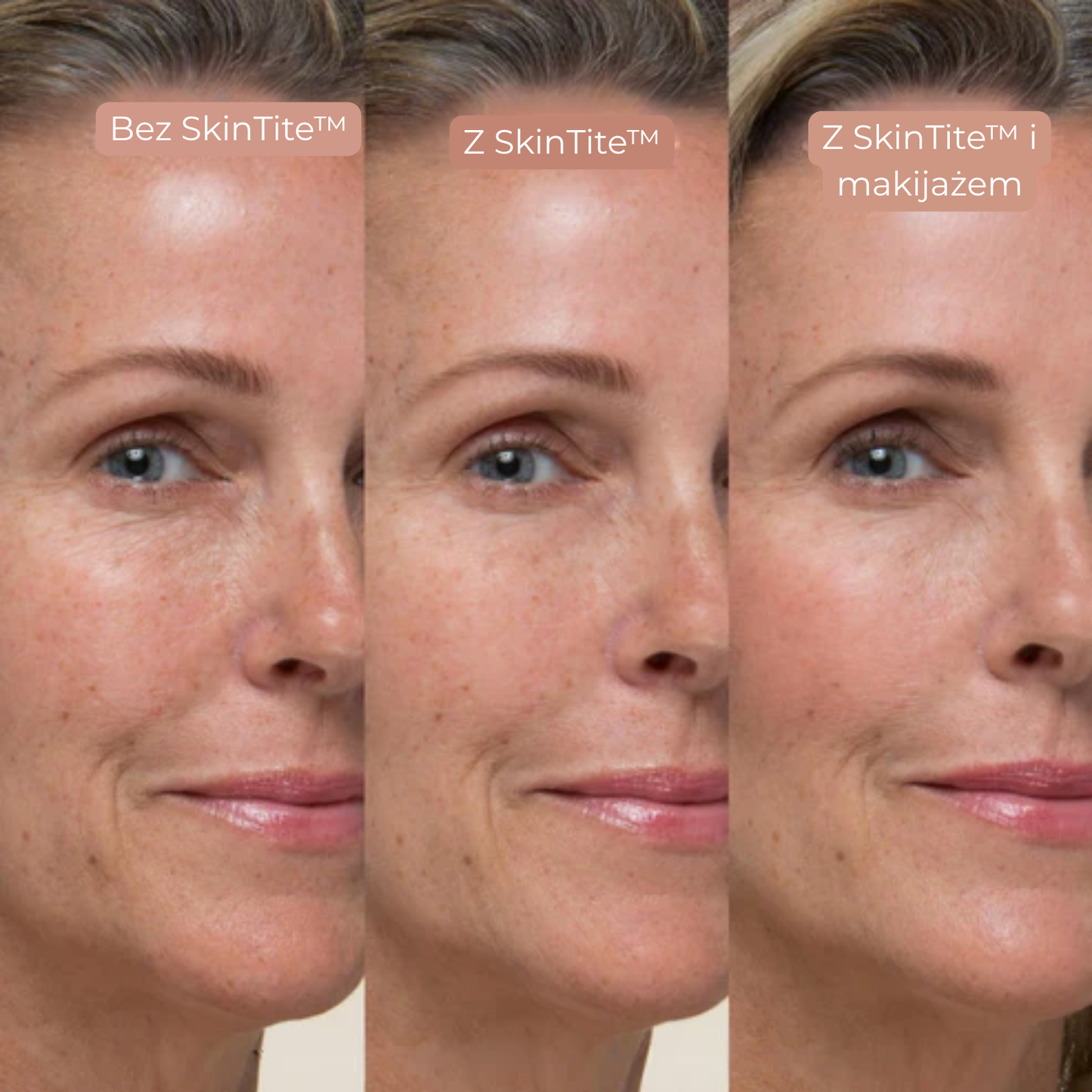 SkinTite™ | Natychmiastowy efekt przeciw opuchliźnie i zmarszczkom