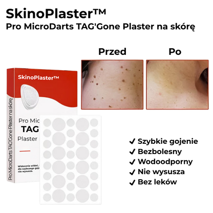SkinoPlaster™ Pro MicroDarts TAG'Gone | Usuń wiszące znamiona bezboleśnie – bez blizn, bez cięć, bez stresu!