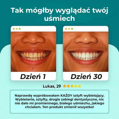 Lunadent™ | Rewolucja w szczotkowaniu – Czyste zęby, bez wysiłku