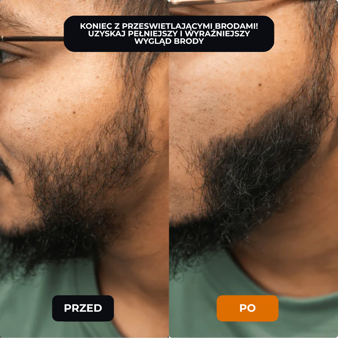 Lugaro | 💥 Pożegnaj się z przerzedzonymi włosami — Natychmiast! | Odkryj sekret pełniejszego, naturalnego wyglądu w kilka sekund