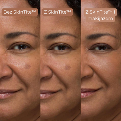 SkinTite™ | Natychmiastowy efekt przeciw opuchliźnie i zmarszczkom