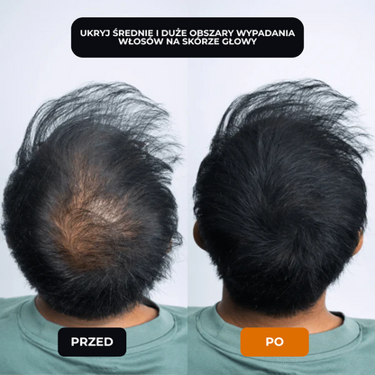 Lugaro | 💥 Pożegnaj się z przerzedzonymi włosami — Natychmiast! | Odkryj sekret pełniejszego, naturalnego wyglądu w kilka sekund