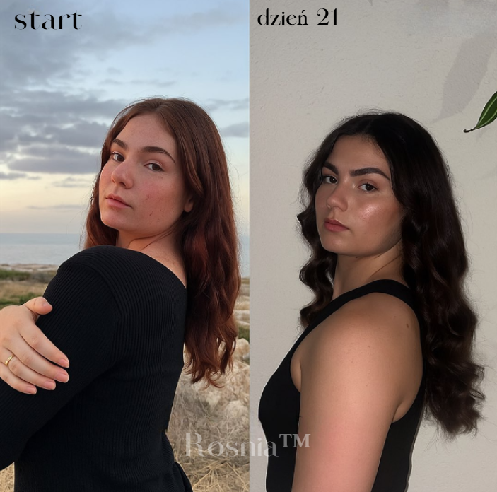 Rosnia™ | Premium Szczotka do Wzrostu Włosów i Pielęgnacji Skóry Głowy | W końcu – naturalny sposób na gęstsze, zdrowsze włosy 🌿✨