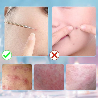 PoreClean™  | Czysta skóra, pewność siebie